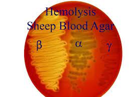 Hemolysis on sheep blood agar