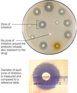 Kirby-Bauer disk diffusion test