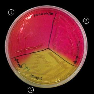 Mannitol Salt Agar plate
