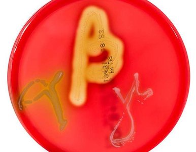 Blood agar plate showing hemolysis