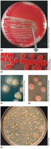 Colony morphology on agar plates