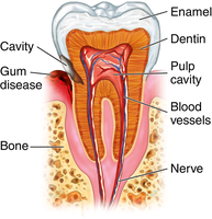 Dental health and sugar intake