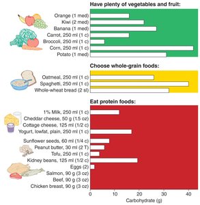Bar chart of carbohydrate content in various foods