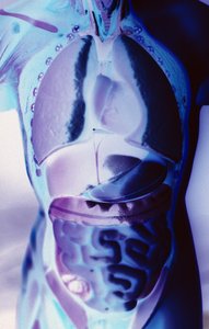 Diverticulosis in the colon