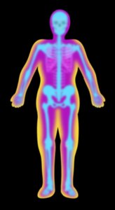 Dual energy X-ray absorptiometry