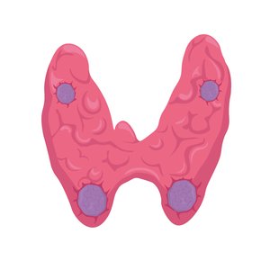 Thyroid gland