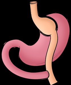 Gastric bypass surgery