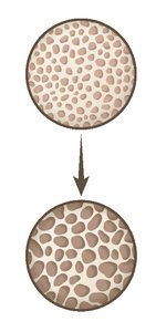 Bone density comparison