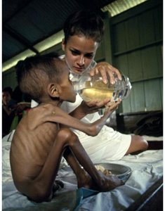 Image representing undernutrition