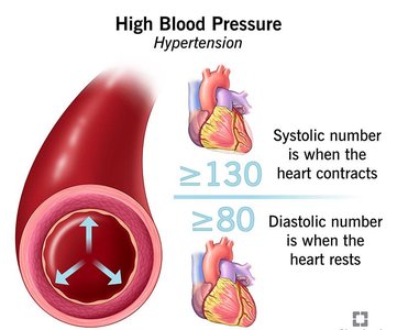 High blood pressure diagram