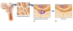 Bone remodeling: osteoclasts and osteoblasts