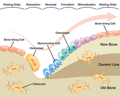 Bone remodeling process