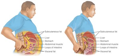 Diagram of visceral and subcutaneous fat storage
