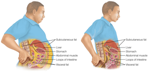Visceral and subcutaneous fat storage in the body