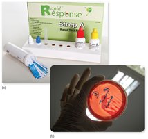 Rapid Strep A test kit and blood agar plate showing beta-hemolysis