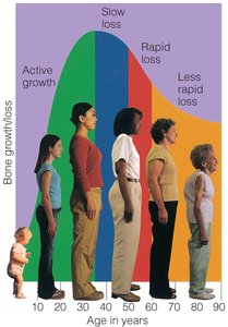 Bone mass changes with age