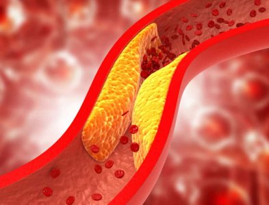 BMJ article abstract on UPF and health outcomes