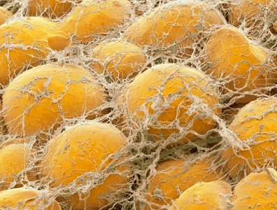 BMJ article conclusions on UPF and health outcomes