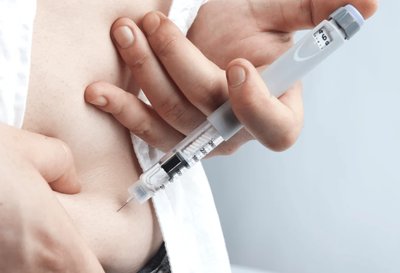 Artery with cholesterol buildup