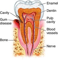 Cross-section of a tooth showing enamel, dentin, pulp cavity, blood vessels, nerve, bone, cavity, and gum disease