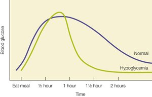Blood glucose changes after a high-carbohydrate meal