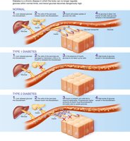 Normal and diabetic blood glucose regulation