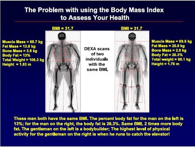 DEXA scans showing BMI limitations