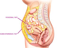 Diagram showing visceral and subcutaneous fat in the human body