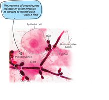 Microscopic image of Candida albicans with pseudohyphae