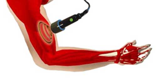 NIR measurement on arm