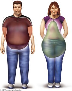 Body fat distribution: apple vs. pear