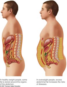 Visceral vs. subcutaneous fat