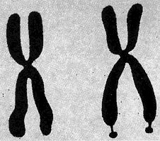 Fragile X chromosomes