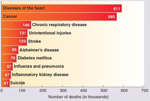 Leading causes of death in the United States