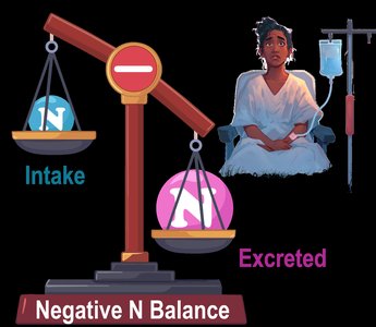 Negative nitrogen balance: intake less than excreted