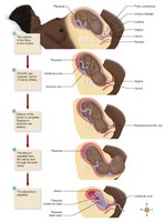 Stages of labor and delivery