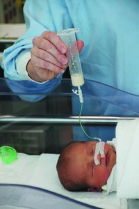 Premature infant receiving tube feeding