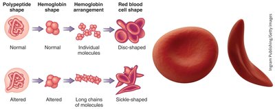 Normal and sickle cell hemoglobin structure