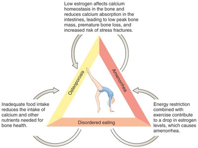 Diagram of the female athlete triad: disordered eating, amenorrhea, osteoporosis