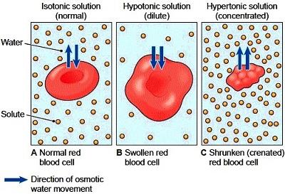 Osmosis and red blood cell shape in different solutions