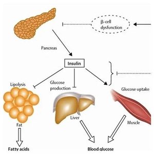 Insulin action on fat, liver, and muscle