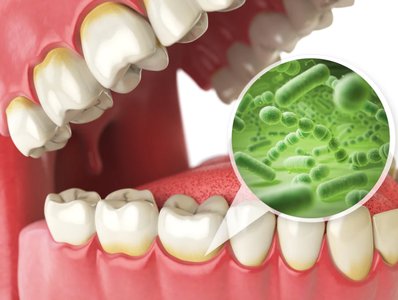 Bacteria in the mouth and on teeth