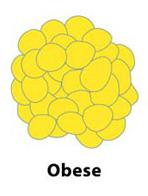 Fat cell size and number in obesity