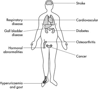 Health consequences of overweight