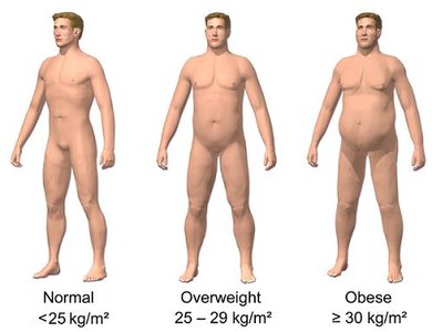 Visual representation of normal, overweight, and obese BMI categories
