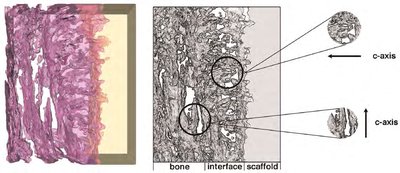 Hydroxyapatite in bone