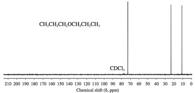 13C NMR spectrum of diethyl ether
