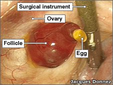 Ovulation process and follicle rupture