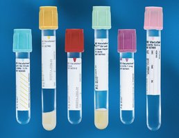 Various color-coded blood collection tubes