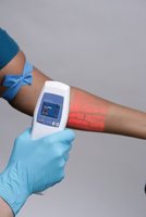 AccuVein viewing system